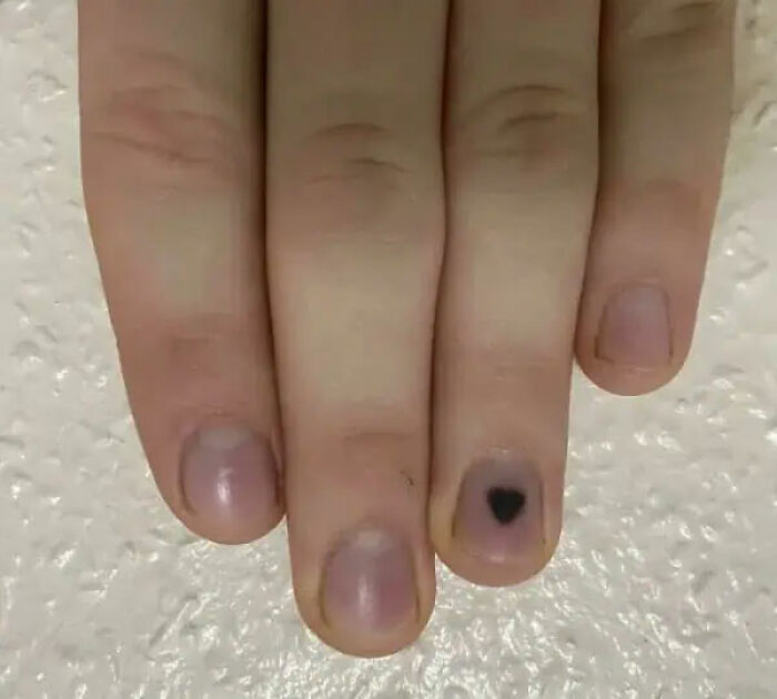 A human hand with a black heart shape on one fingernail, representing the strange and amazing human body.