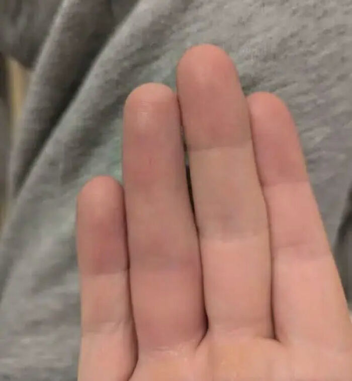A human hand with three fingers next to each other, emphasizing the strange and amazing human body.