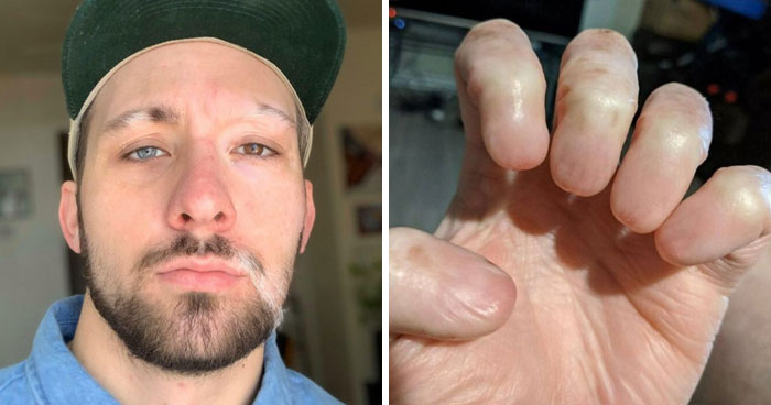 80 Photos Proving The Human Body Is As Strange As It Is Amazing