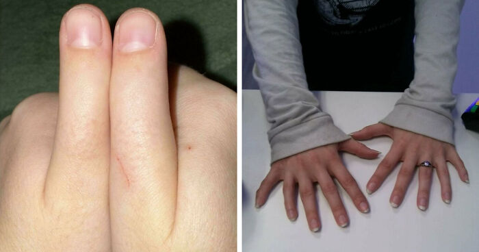 80 Photos Proving The Human Body Is As Strange As It Is Amazing