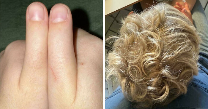 80 Photos Proving The Human Body Is As Strange As It Is Amazing