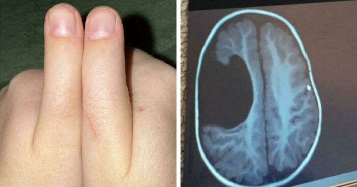 80 Photos Proving The Human Body Is As Strange As It Is Amazing