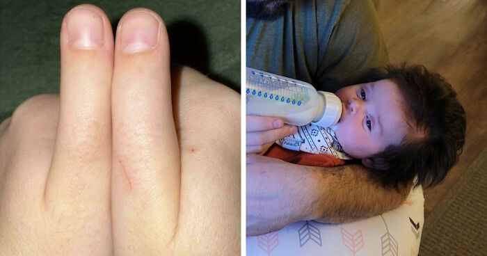 80 Photos Proving The Human Body Is As Strange As It Is Amazing