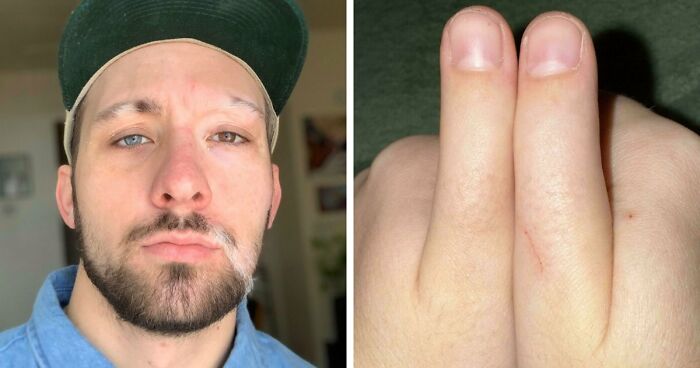 80 Photos Proving The Human Body Is As Strange As It Is Amazing