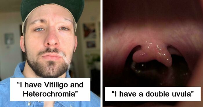 80 Photos Proving The Human Body Is As Strange As It Is Amazing