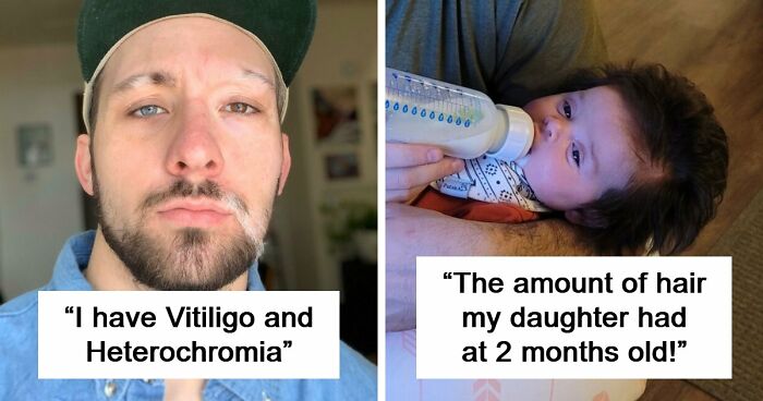 80 Photos Proving The Human Body Is As Strange As It Is Amazing