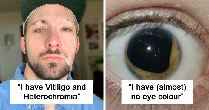80 Photos Proving The Human Body Is As Strange As It Is Amazing