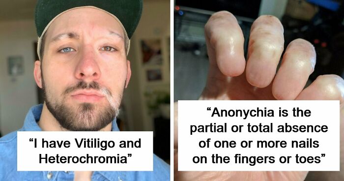 80 Photos Proving The Human Body Is As Strange As It Is Amazing