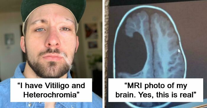 80 Photos Proving The Human Body Is As Strange As It Is Amazing