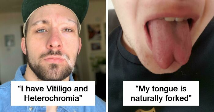 80 Photos Proving The Human Body Is As Strange As It Is Amazing