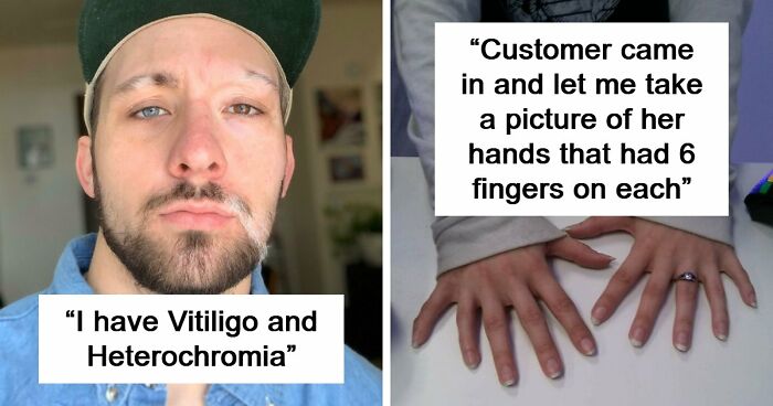 80 Photos Proving The Human Body Is As Strange As It Is Amazing