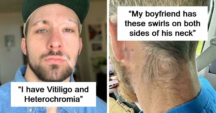 80 Photos Proving The Human Body Is As Strange As It Is Amazing