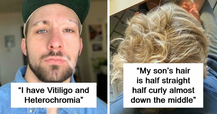 80 Photos Proving The Human Body Is As Strange As It Is Amazing