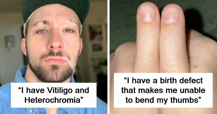 80 Photos Proving The Human Body Is As Strange As It Is Amazing