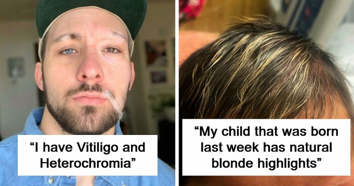 80 Photos Proving The Human Body Is As Strange As It Is Amazing