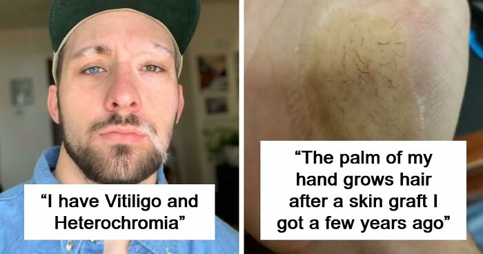 80 Photos Proving The Human Body Is As Strange As It Is Amazing