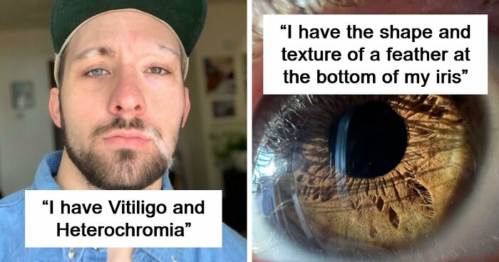 80 Photos Proving The Human Body Is As Strange As It Is Amazing