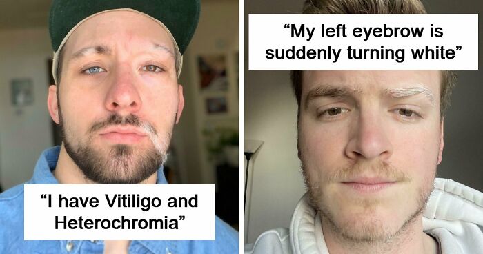 80 Photos Proving The Human Body Is As Strange As It Is Amazing