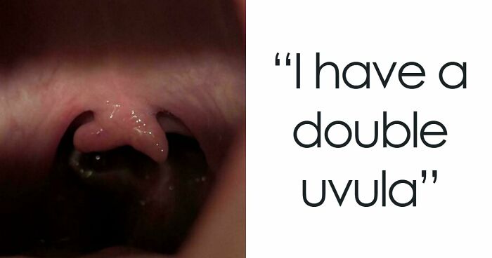 80 Photos Proving The Human Body Is As Strange As It Is Amazing