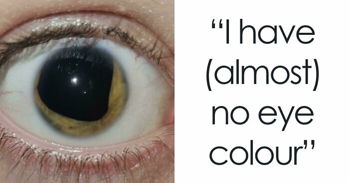 80 Photos Proving The Human Body Is As Strange As It Is Amazing