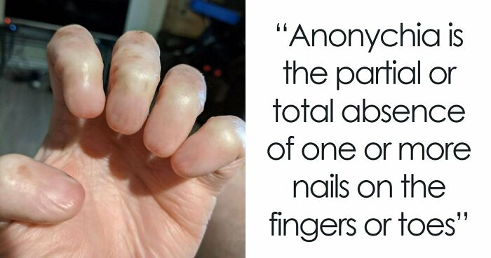 80 Photos Proving The Human Body Is As Strange As It Is Amazing