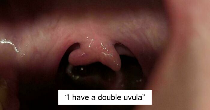 80 Photos Proving The Human Body Is As Strange As It Is Amazing