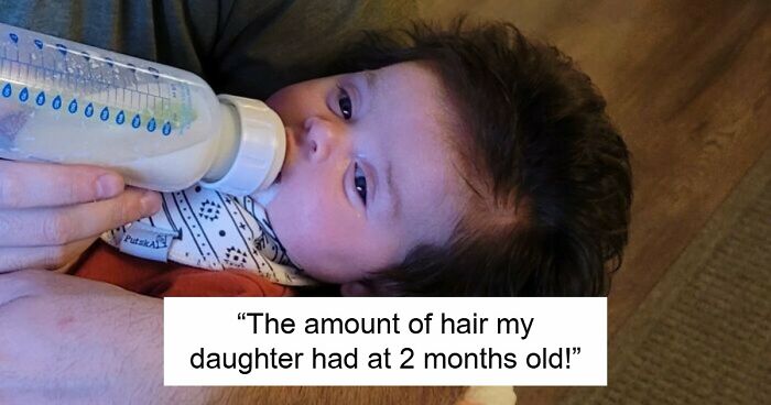 80 Photos Proving The Human Body Is As Strange As It Is Amazing