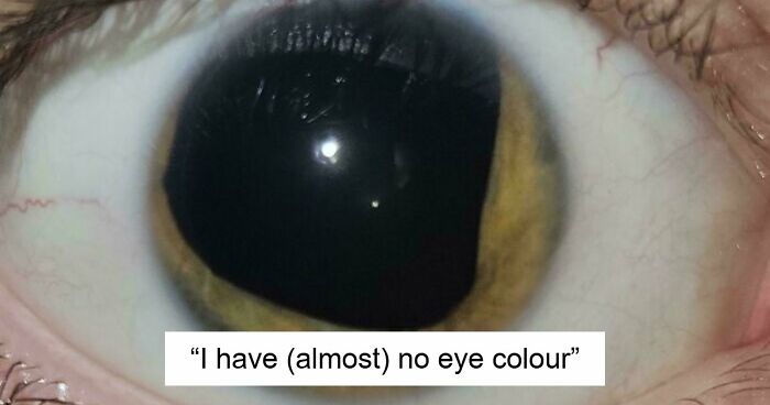 80 Photos Proving The Human Body Is As Strange As It Is Amazing