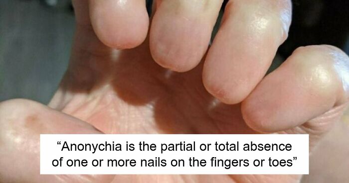 80 Photos Proving The Human Body Is As Strange As It Is Amazing