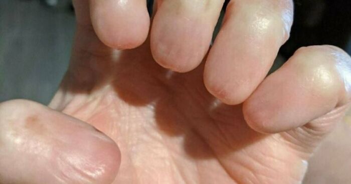 80 Photos Proving The Human Body Is As Strange As It Is Amazing