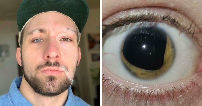 80 Photos Proving The Human Body Is As Strange As It Is Amazing