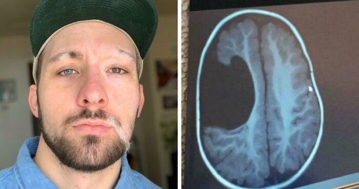 80 Photos Proving The Human Body Is As Strange As It Is Amazing