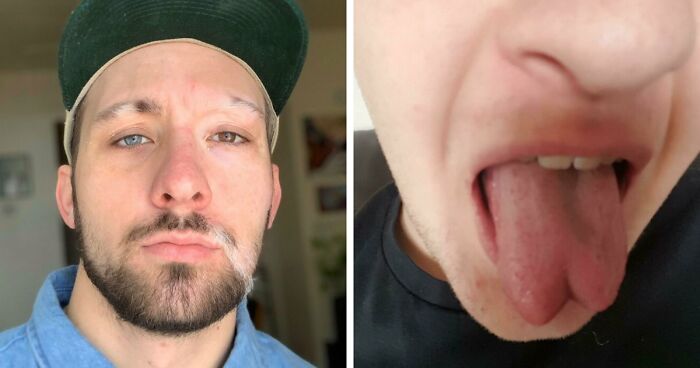 80 Photos Proving The Human Body Is As Strange As It Is Amazing