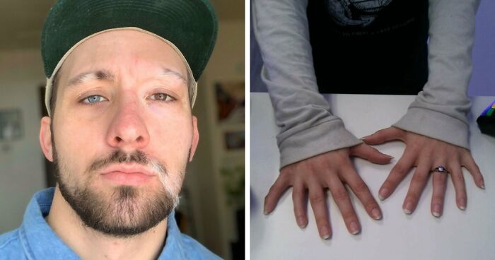 80 Photos Proving The Human Body Is As Strange As It Is Amazing