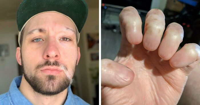 80 Photos Proving The Human Body Is As Strange As It Is Amazing