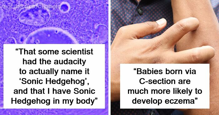 “Blew My Frickin’ Mind”: 46 Facts About The Human Body That Impressed Medical Students