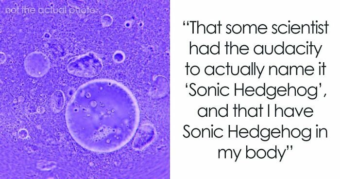 “Blew My Frickin’ Mind”: 46 Facts About The Human Body That Impressed Medical Students