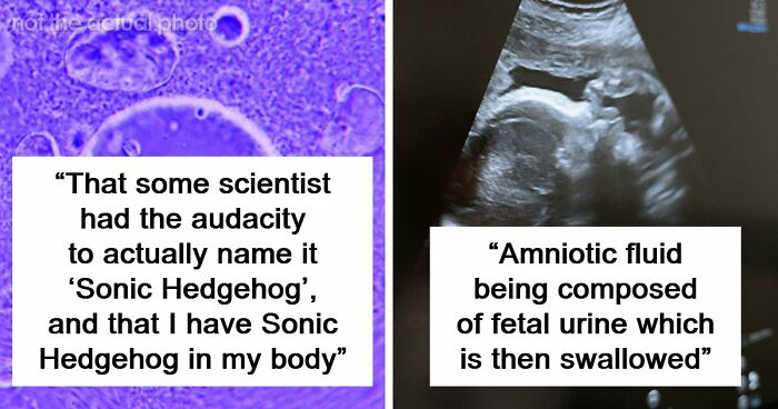 “Blew My Frickin’ Mind”: 46 Facts About The Human Body That Impressed Medical Students