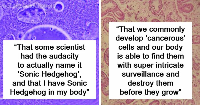 “Blew My Frickin’ Mind”: 46 Facts About The Human Body That Impressed Medical Students