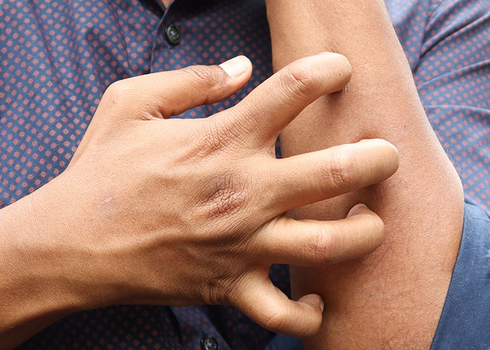 Person scratching arm, a fact about the human body.
