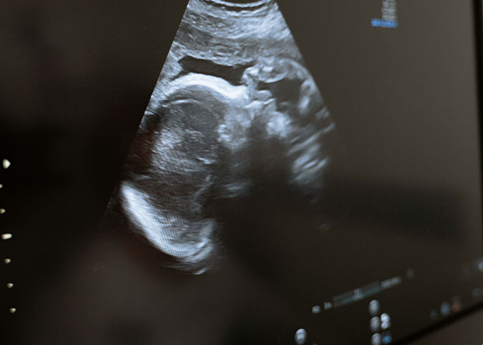 An ultrasound image displaying the profile of a fetus, showcasing the intricacies of the human body facts.