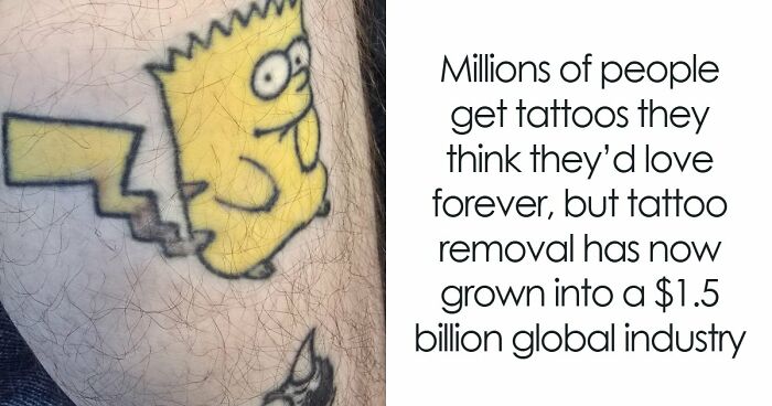 The Thing You Got Permanently Inked On Your Body At 19 Is Now A $1.5 Billion Regret Industry