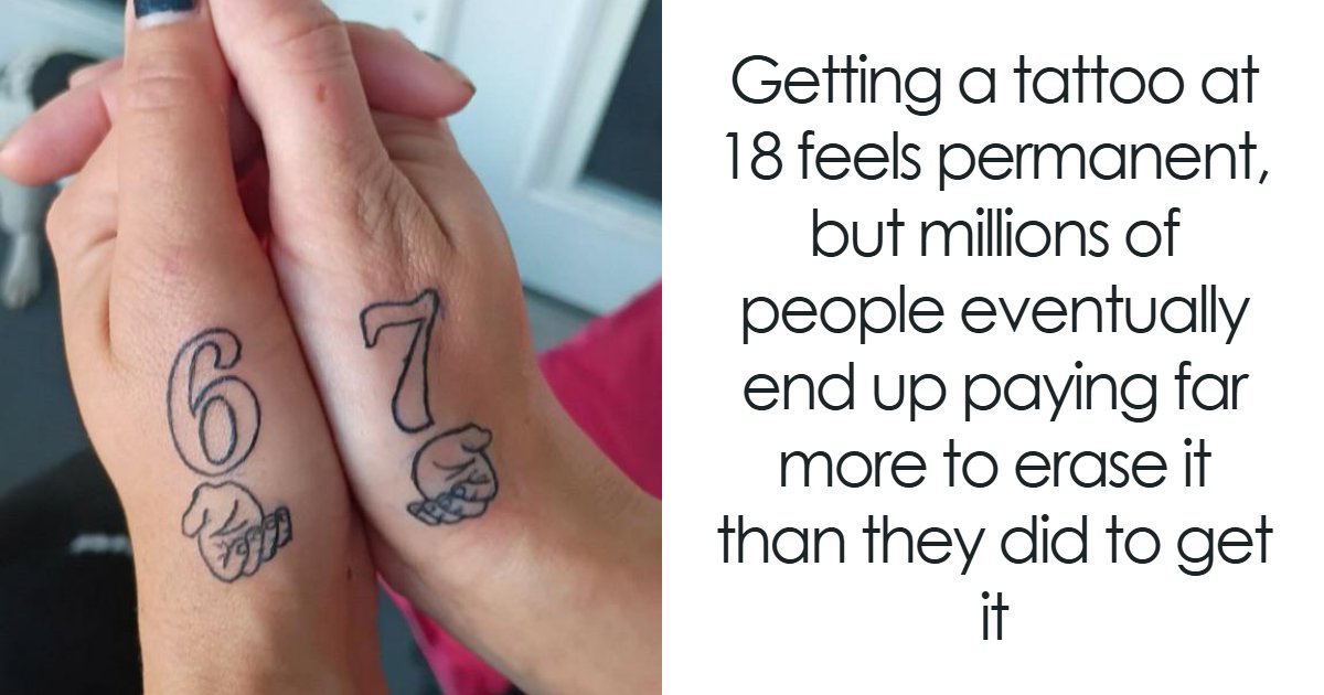The Tattoos People Swore They'd Love Forever Have Created A Billion-Dollar Industry Of Regret