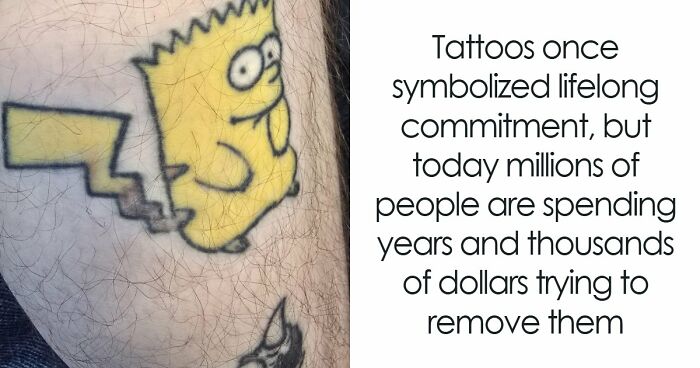 The Thing You Got Permanently Inked On Your Body At 19 Is Now A $1.5 Billion Regret Industry