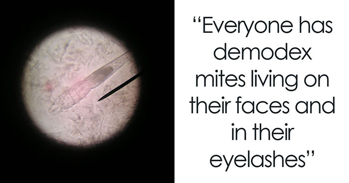 50 Disturbing Facts That Completely Changed The Way People See The World