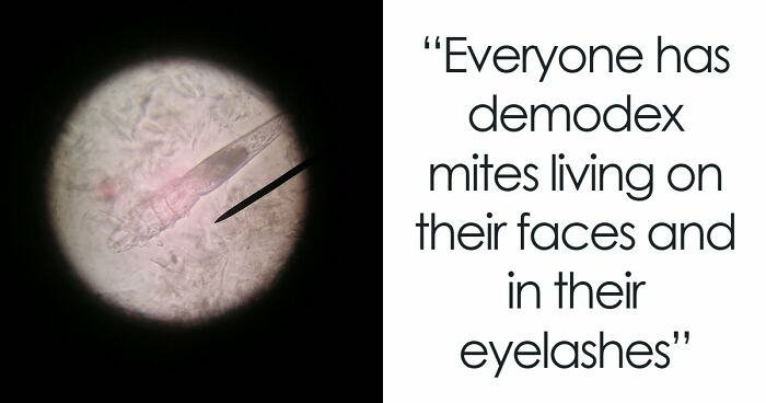 50 Disturbing Facts That Completely Changed The Way People See The World