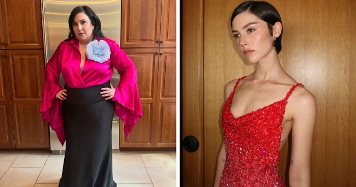 15 Before-And-After Photos Of Celebrities Who Couldn’t Stop Getting Plastic Surgeries