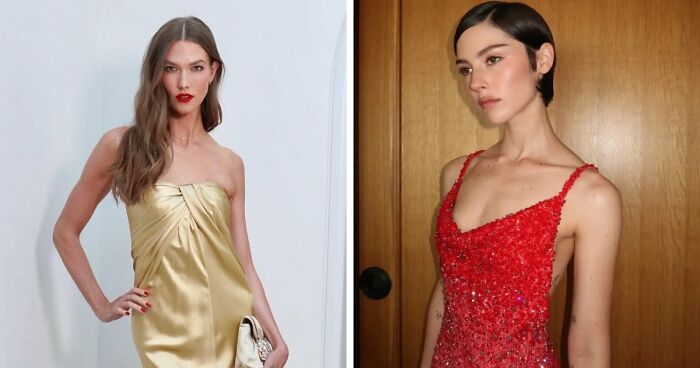 15 Before-And-After Photos Of Celebrities Who Couldn’t Stop Getting Plastic Surgeries