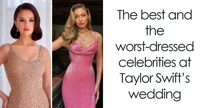 15 Before-And-After Photos Of Celebrities Who Couldn’t Stop Getting Plastic Surgeries