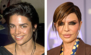 15 Pre-Plastic Surgery Photos Of Celebrities That Are Hard To Process